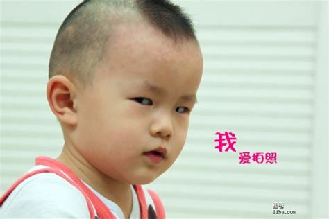 斜眼看人|孩子斜视只是影响外表？远远不止!